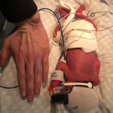 One of Espanola’s youngest needs help